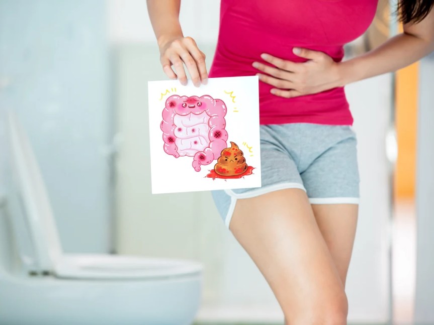 Blood in Stools, Causes and Symptoms, What It Means for&nbsp;Health